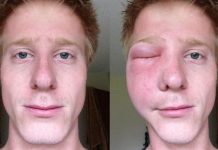 Belasan Tentara Zionis Israel Diserang Tawon di Gaza Selatan