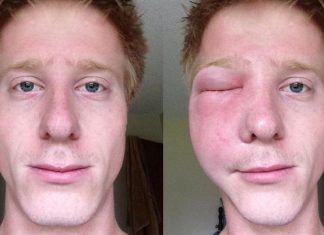 Belasan Tentara Zionis Israel Diserang Tawon di Gaza Selatan