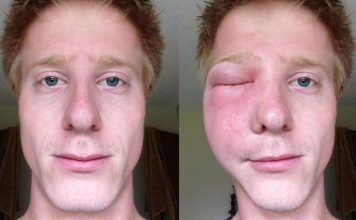 Belasan Tentara Zionis Israel Diserang Tawon di Gaza Selatan